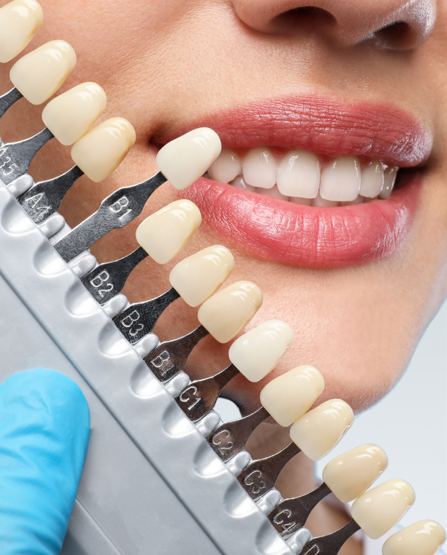 Cosmetic Dentistry